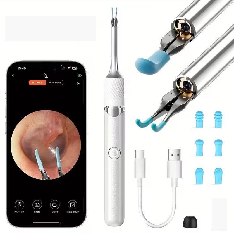 3 in 1 Wi-Fi Enabled Ear Pick Tweezers 12MP Camera Earwax Removal Tool