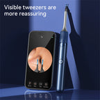 3 in 1 Smart Visual(Ear) Wax Removal Kit - Multiverse store