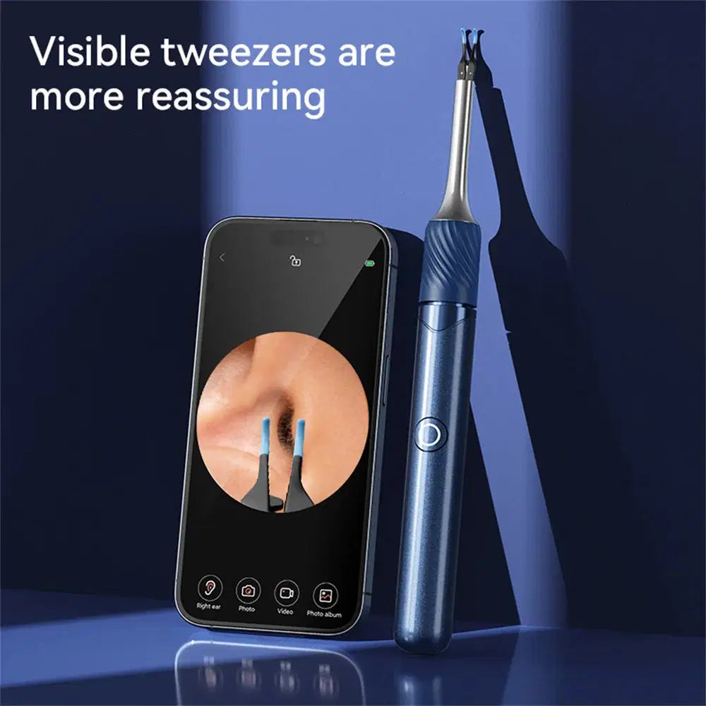 3 in 1 Smart Visual(Ear) Wax Removal Kit - Multiverse store