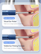 3 in 1 Smart Visual(Ear) Wax Removal Kit - Multiverse store