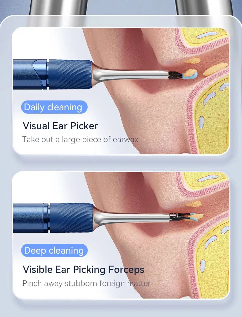 3 in 1 Smart Visual(Ear) Wax Removal Kit - Multiverse store
