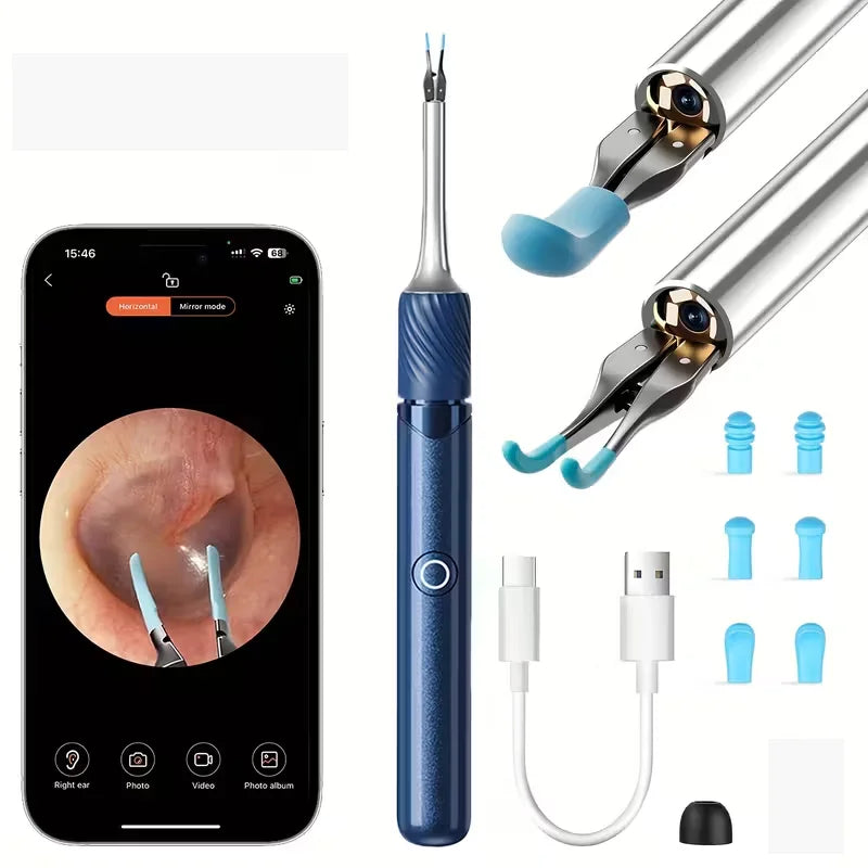 3 in 1 Wi-Fi Enabled Ear Pick Tweezers 12MP Camera Earwax Removal Tool