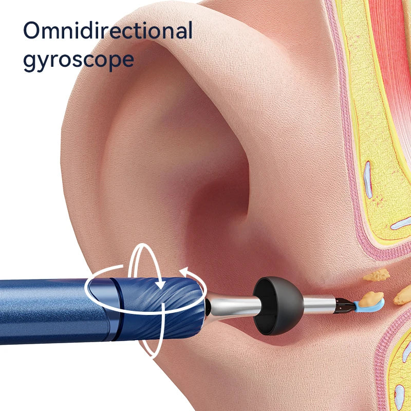 3 in 1 Wi-Fi Enabled Ear Pick Tweezers 12MP Camera Earwax Removal Tool